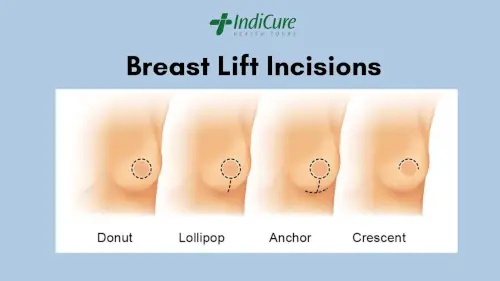 Breast Lift Incisions